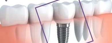La imagen 1 de la Empresa R3D CONSULTORIOS ODONTOLÓGICOS Odontologia en Lima LAM