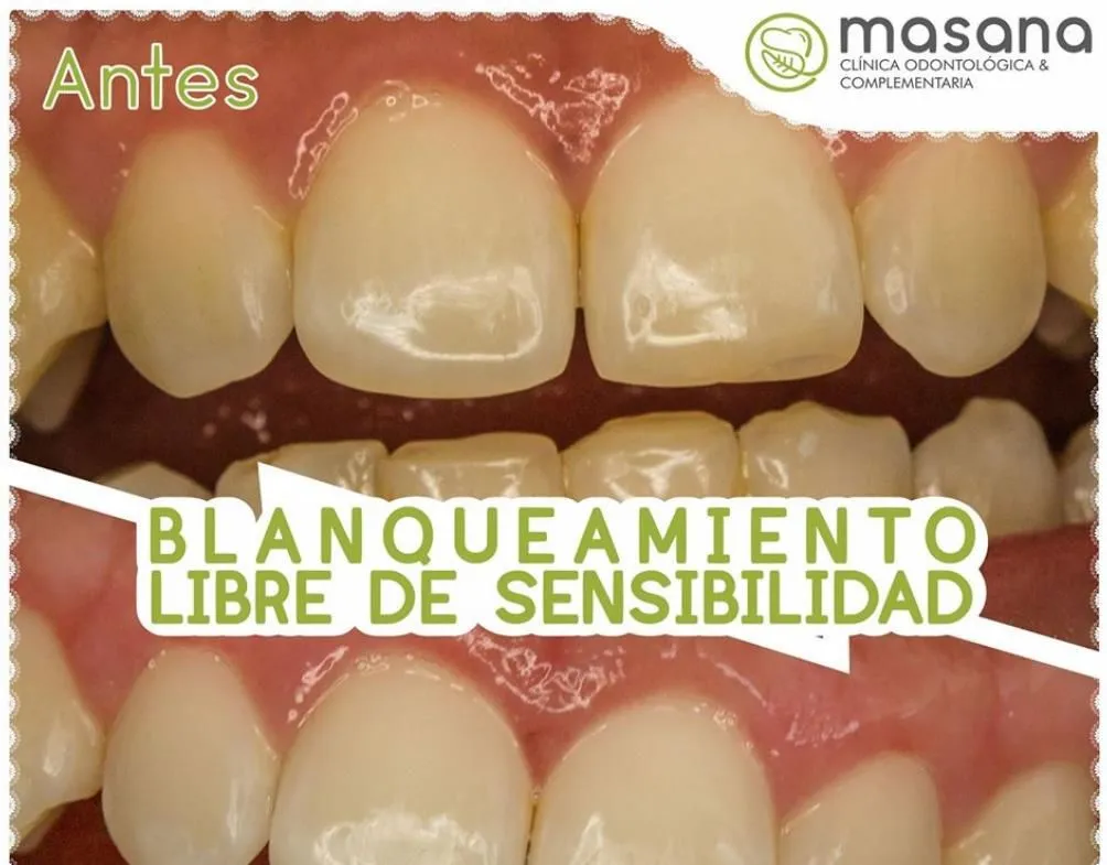 La imagen 2 de la Empresa MASANA CLÍNICA ODONTOLOGÍA Y COMPLEMENTARIA