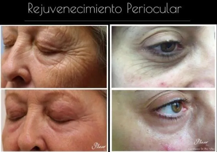 La imagen 1 de la Empresa PLEXR PLUS