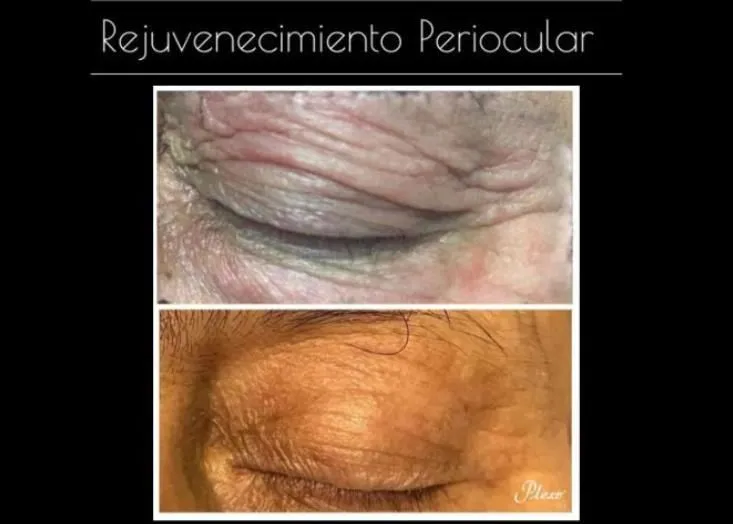 La imagen 3 de la Empresa PLEXR PLUS