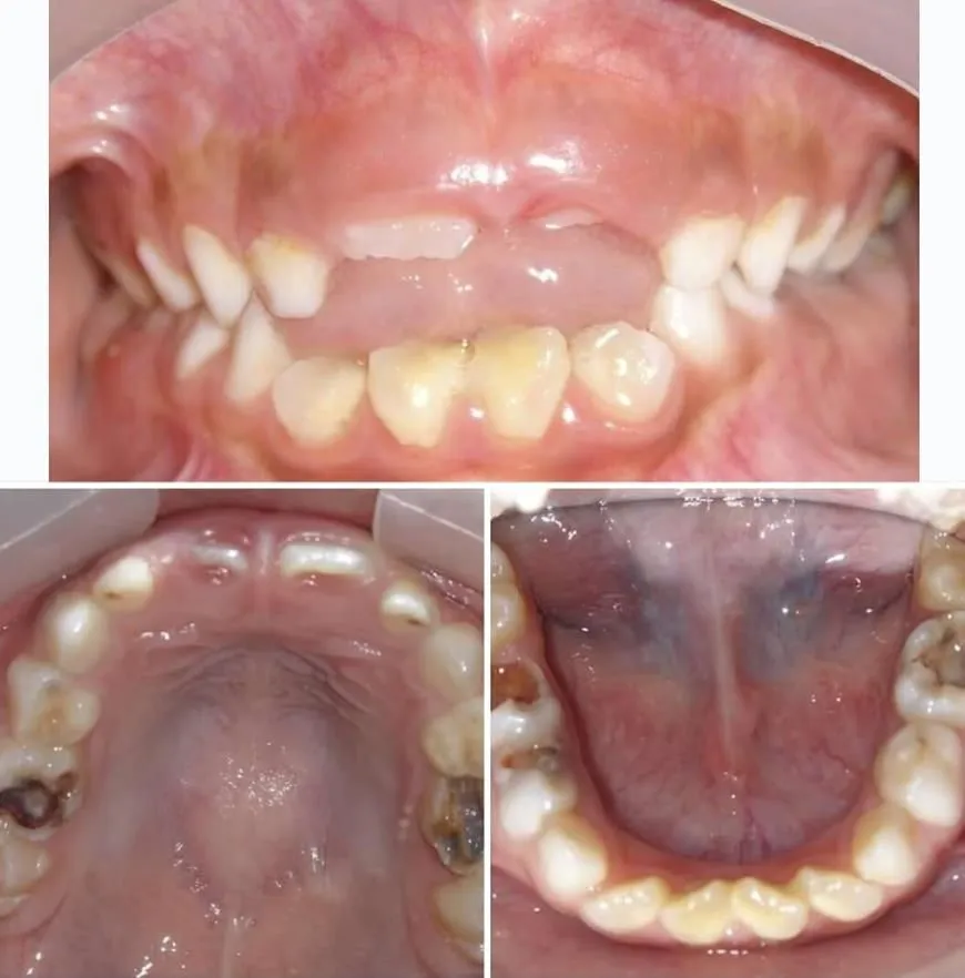 La imagen 2 de la Empresa CENTRO ODONTOLÓGICO MUNDO DENTAL KIDS